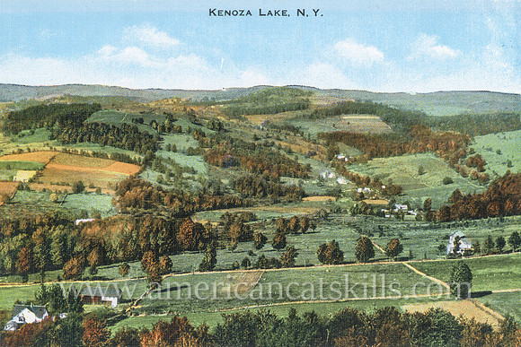 Vintage postcard from photographer Otto Hillig showing the rural countryside at Kenoza Lake in Sullivan County, New York.